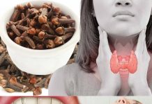 Imate suvo ili upaljeno grlo? Evo kako vam karanfilčići mogu pomoći u tome